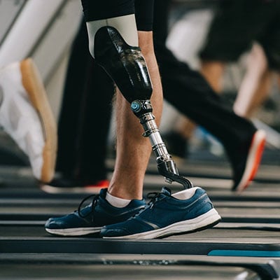 PROSTHETIC LIMBS